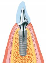 Logo Oralchirurg : Dr. Frank Seidel, , , Kleinmachnow