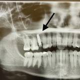 , Dr. med. Dr. med. dent. Hakan Tastan, Mund-Kiefer-Gesichtschirurgie impadia, Praxis für Mund-Kiefer-Gesichtschirurgie, Köln, Zahnarzt, MKG-Chirurg, Oralchirurg