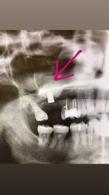 , Dr. med. Dr. med. dent. Hakan Tastan, Mund-Kiefer-Gesichtschirurgie impadia, Praxis für Mund-Kiefer-Gesichtschirurgie, Köln, Zahnarzt, MKG-Chirurg, Oralchirurg