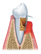 , Dr. Frank Seidel, Kleinmachnow, Oralchirurg