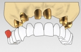 , Dr. Frank Seidel, Kleinmachnow, Oralchirurg