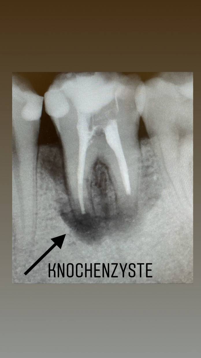 , Dr. med. Dr. med. dent. Hakan Tastan, Mund-Kiefer-Gesichtschirurgie impadia, Praxis für Mund-Kiefer-Gesichtschirurgie, Köln, Zahnarzt, MKG-Chirurg, Oralchirurg